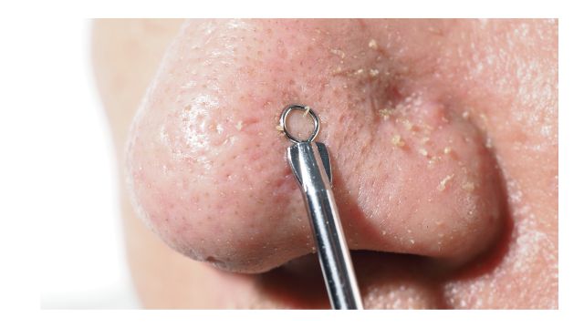 やめてよかった!毛穴開きを加速させるNG行動!/Stop It for Good! Habits to Avoid to Prevent Enlarged Pores!
