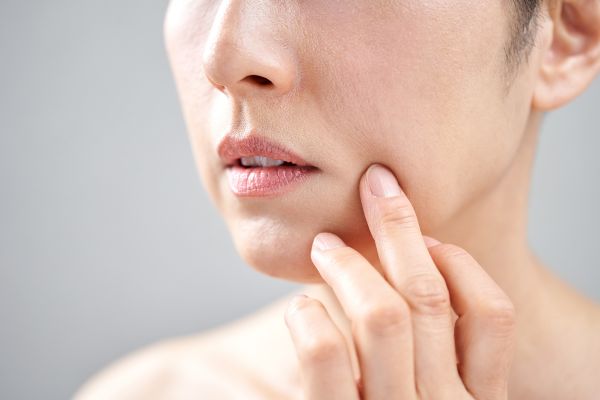 シミが出来やすい肌になってない？/”Is your skin prone to spots?”